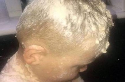 Mother washes her 3-year-old son’s hair 23 times here is why