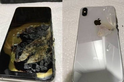 US - iPhone XS Max catches on fire in mans pocket